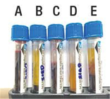 응고된 푸른 상부 크브크 배큐테이너 혈액 튜브, 혈액 샘플 수집 유리병 협력 업체