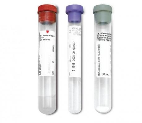 항응혈성 구연산나트륨   소듐 플루오라이드 색 가이드 채혈 튜브 협력 업체
